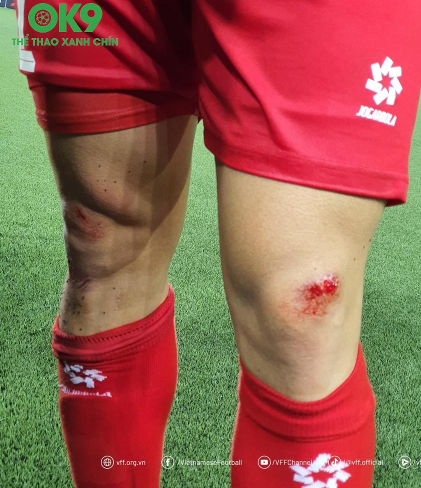 Mặt cỏ sân tạo khiến nhiều cầu thủ ĐT Việt Nam trầy xước hết chân (Ảnh: VFF)